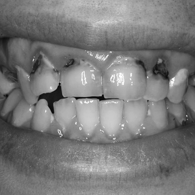 Dentists in Biggleswade Bedfordshire