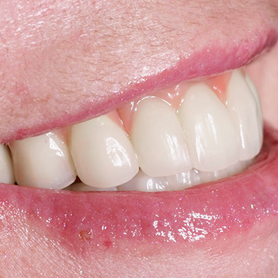Dentists in Biggleswade Bedfordshire