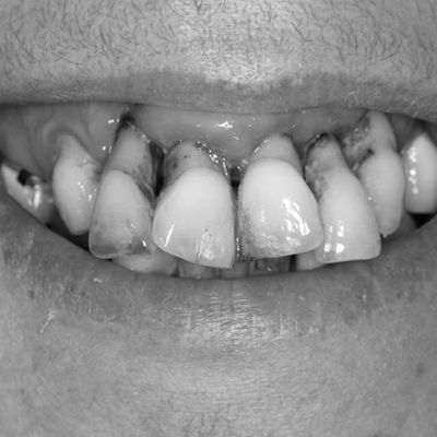 Dentists in Biggleswade Bedfordshire