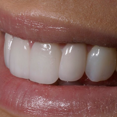 Dentists in Biggleswade Bedfordshire
