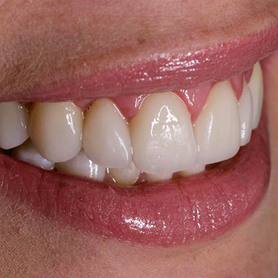 Dentists in Biggleswade Bedfordshire