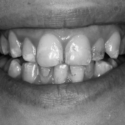 Dentists in Biggleswade Bedfordshire